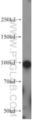 GLI2 Antibody in Western Blot (WB)