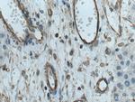 BSEP Antibody in Immunohistochemistry (Paraffin) (IHC (P))