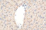 BSEP Antibody in Immunohistochemistry (Paraffin) (IHC (P))