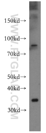 SLC24A4 Antibody in Western Blot (WB)