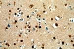 BRN2 Antibody in Immunohistochemistry (Paraffin) (IHC (P))