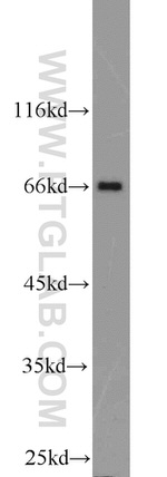 POU3F3 Antibody in Western Blot (WB)