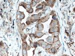 VEGF Antibody in Immunohistochemistry (Paraffin) (IHC (P))