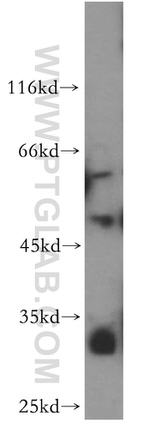 ZFP36L2 Antibody in Western Blot (WB)