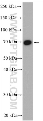 GUCY1B3 Antibody in Western Blot (WB)