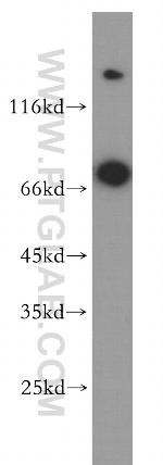 GUCY1B3 Antibody in Western Blot (WB)