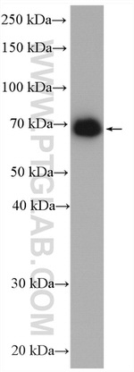 GUCY1B3 Antibody in Western Blot (WB)