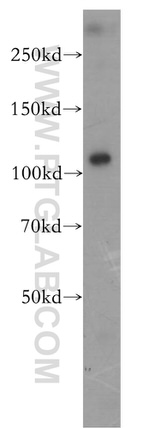 P2RX5 Antibody in Western Blot (WB)