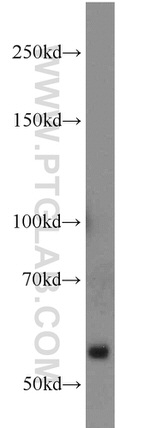 NOX2 Antibody in Western Blot (WB)