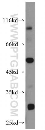 DPP7 Antibody in Western Blot (WB)