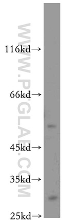 DPP7 Antibody in Western Blot (WB)