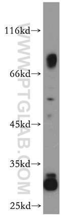 DPP7 Antibody in Western Blot (WB)