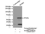 SGMS1 Antibody in Immunoprecipitation (IP)