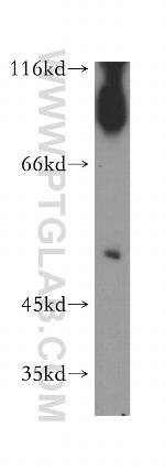 SGMS1 Antibody in Western Blot (WB)