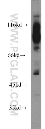 SGMS1 Antibody in Western Blot (WB)