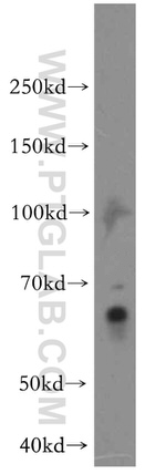 IKZF3 Antibody in Western Blot (WB)