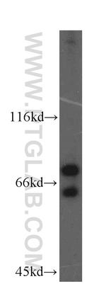 IKZF3 Antibody in Western Blot (WB)