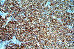 BAG1 Antibody in Immunohistochemistry (Paraffin) (IHC (P))