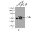 BAG1 Antibody in Immunoprecipitation (IP)