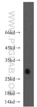 CRISP2 Antibody in Western Blot (WB)