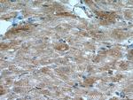 BMPR2 Antibody in Immunohistochemistry (Paraffin) (IHC (P))