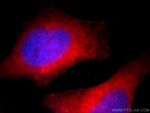 ACTN4 Antibody in Immunocytochemistry (ICC/IF)