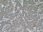 ACTN4 Antibody in Immunohistochemistry (Paraffin) (IHC (P))