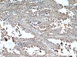 ACTN4 Antibody in Immunohistochemistry (Paraffin) (IHC (P))