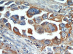 ACTN4 Antibody in Immunohistochemistry (Paraffin) (IHC (P))