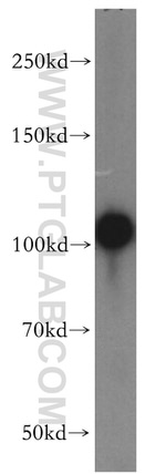 ACTN4 Antibody in Western Blot (WB)