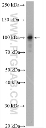 ACTN4 Antibody in Western Blot (WB)