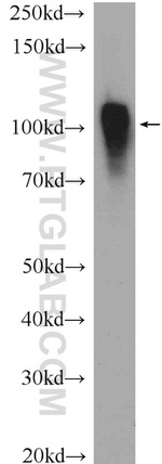 ACTN4 Antibody in Western Blot (WB)