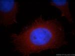 ACTN4 Antibody in Immunocytochemistry (ICC/IF)