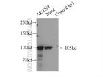 ACTN4 Antibody in Immunoprecipitation (IP)