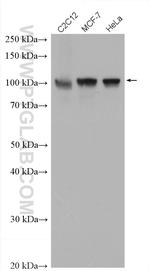 ACTN4 Antibody in Western Blot (WB)