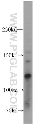 EPAC2 Antibody in Western Blot (WB)