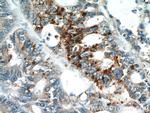 GOLPH3 Antibody in Immunohistochemistry (Paraffin) (IHC (P))