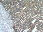 CDK6 Antibody in Immunohistochemistry (Paraffin) (IHC (P))