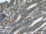 CDK6 Antibody in Immunohistochemistry (Paraffin) (IHC (P))