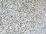 CDK6 Antibody in Immunohistochemistry (Paraffin) (IHC (P))