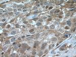 CDK6 Antibody in Immunohistochemistry (Paraffin) (IHC (P))