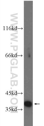 CDK6 Antibody in Western Blot (WB)