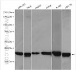 CDK6 Antibody in Western Blot (WB)