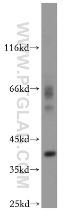 CDK6 Antibody in Western Blot (WB)