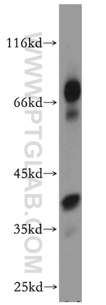 CDK6 Antibody in Western Blot (WB)