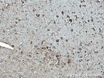 TRPA1 Antibody in Immunohistochemistry (Paraffin) (IHC (P))