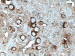 TRPA1 Antibody in Immunohistochemistry (Paraffin) (IHC (P))