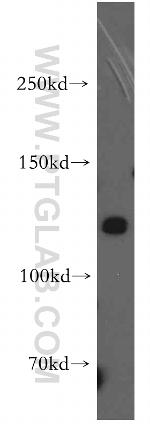 TRPA1 Antibody in Western Blot (WB)