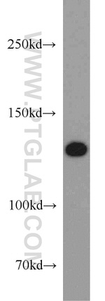 TRPA1 Antibody in Western Blot (WB)