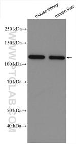 Calcium Sensing Receptor Antibody in Western Blot (WB)